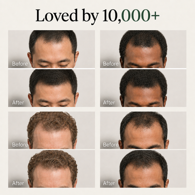 ZeroVia Solid Shampoo for Men