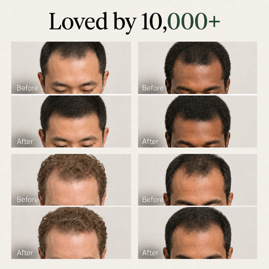 ZeroVia Solid Shampoo for Men
