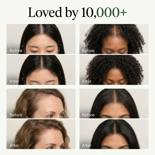 ZeroVia Scalp Reset Bar